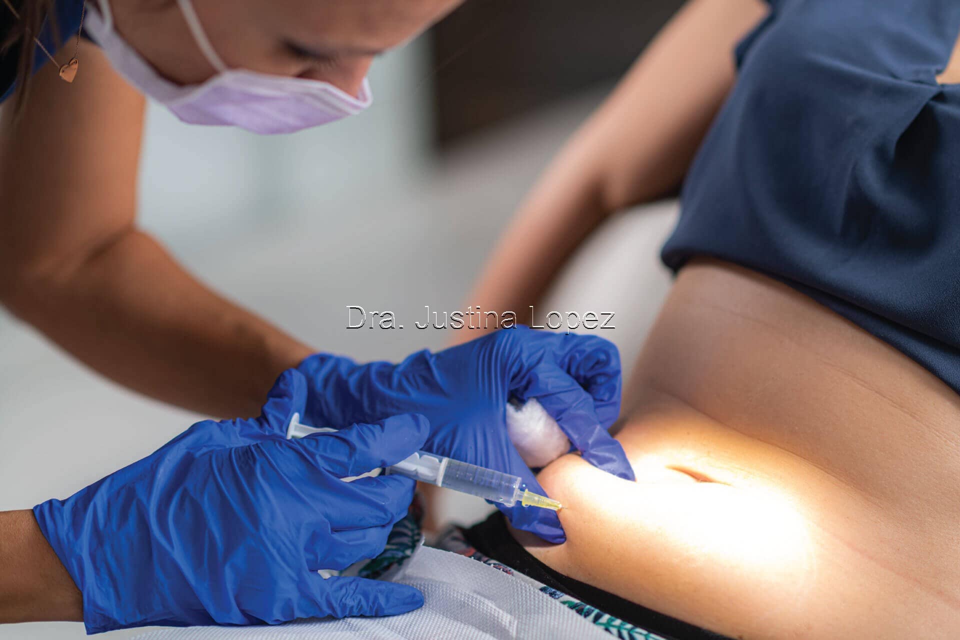 Carboxiterapia